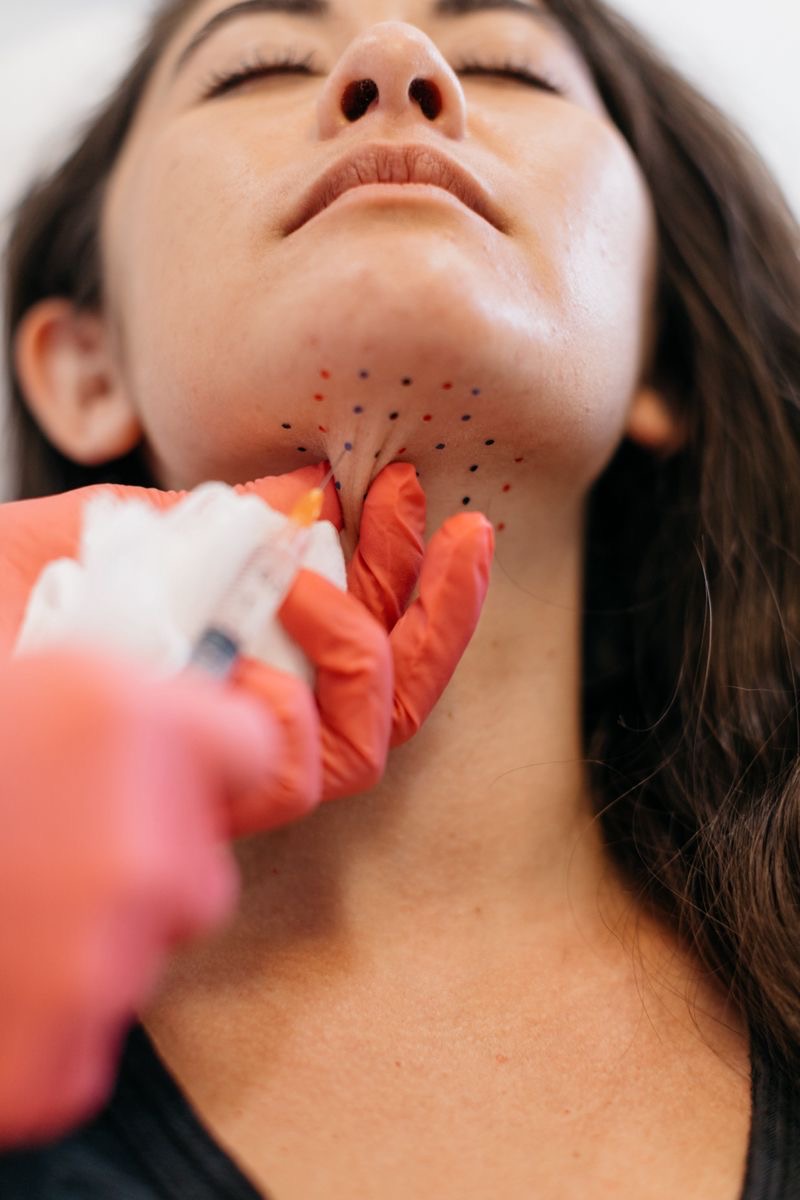 Kybella/Deso Face — 2